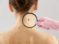 Skin Cancer Spreads through Body via Trail, study