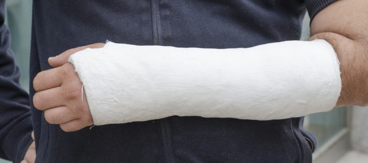 Healing Injuries Could Be Faster Thanks To This 3-D Printed Cast