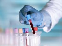 New Blood Test Detects Warning Signs of Heart Attack