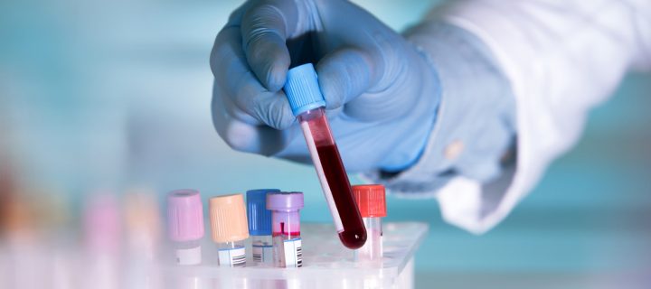 New Blood Test Detects Warning Signs of Heart Attack