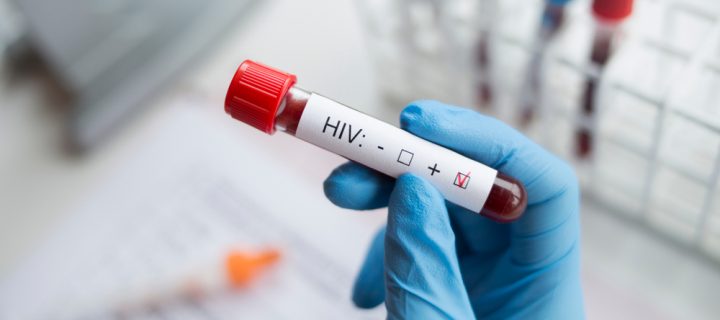 HIV Prevention Drug Works in First Real-World Test
