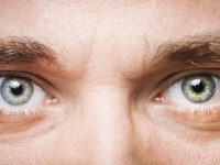 What is Anisocoria and How Did David Bowie Have it?