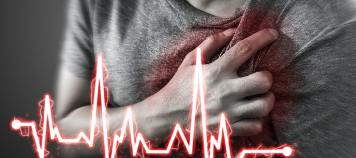 Half of Heart Attacks are Symptomless, Study Says