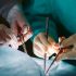 Forget Organ Transplants – China Wants to do Full-Body Transplants