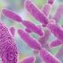 Bacteria with Superbug Genes Discovered in the U.S.