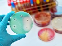 Harvard Scientists Release Time-lapse Video of Evolving Antibiotic-resistant Bacteria