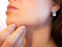 Here’s Why the Heck You’re Watching Another Pimple Popping Video
