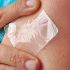 Will This New Skin Patch Put an End to Peanut Allergies?