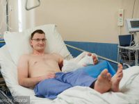In a World First, Man Born Without Hands Gets One from Donor
