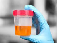 A Urine Test Might Be as Effective as a Smear When It Comes to Cervical Cancer: Study