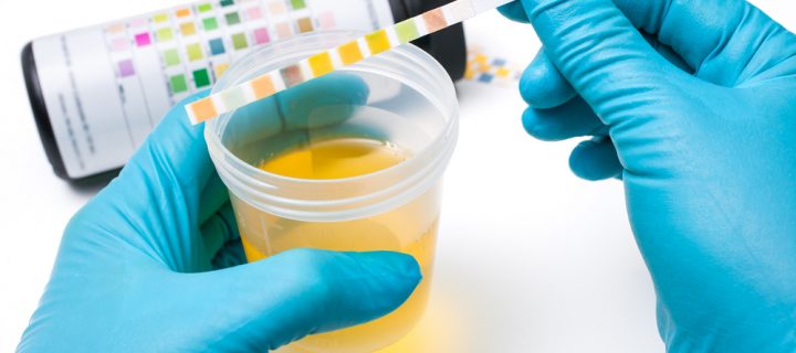 Not Sure What You Just Ate? This Urine Test Can Tell You