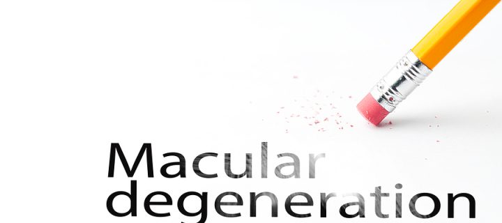 Important Facts About Age-Related Macular Degeneration