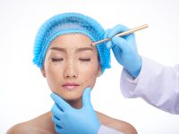 Here Are 5 Types of Facelifts and What They Can Do For You