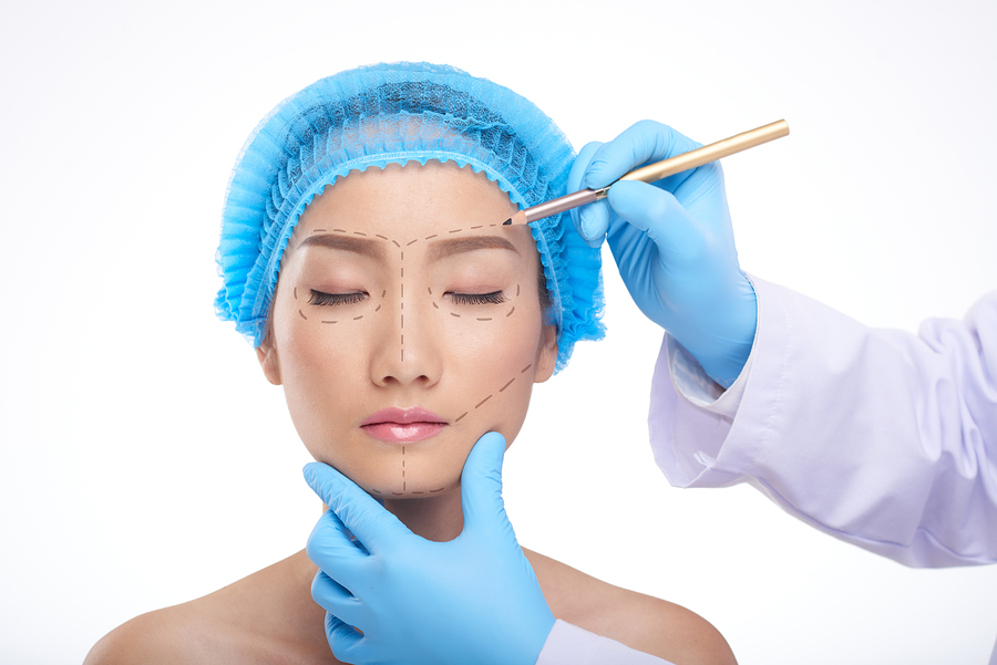 Here Are 5 Types of Facelifts and What They Can Do For You - RateMDs