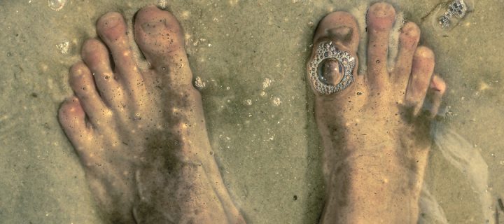 Australian Teen Has His Legs Munched on by Sea Fleas in a Freak