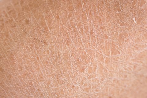 The 7 Best Ways to Treat Itchy, Dry Skin