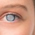 5 Things You Probably Didn’t Know About Cataracts, but Should