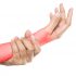 7 Things You Didn’t Know About Carpal Tunnel Syndrome and How to Treat It