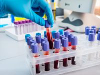New Blood Test Detects Cancer In Early Stages
