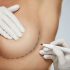 Getting a Boob Job Might Cause a Rare Type of Cancer