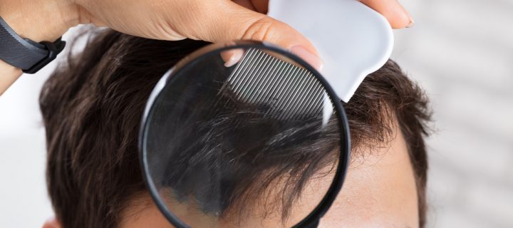 Your Child Has Lice: How to Survive the Next Week