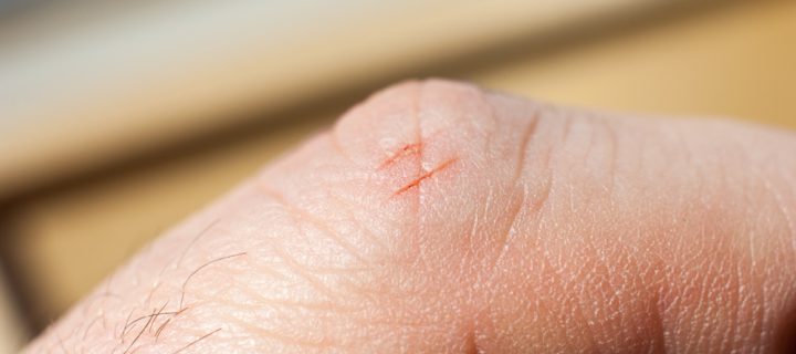 Why Paper Cuts Hurt So Damn Much