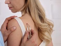 How To Remove Skin Tags, According To Dermatologists