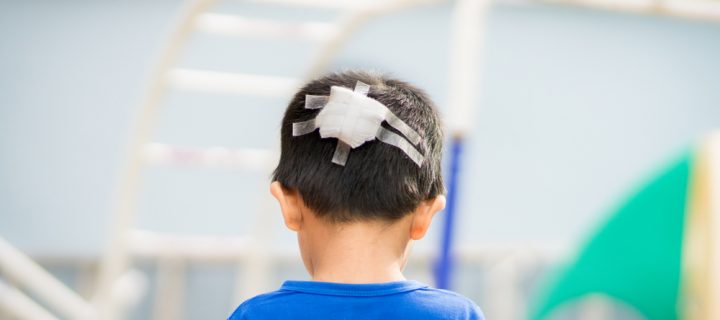 These are the Most Dangerous Spots for Children’s’ Head Injuries