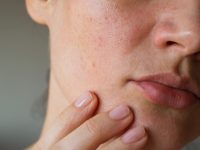 Common Mistakes You’re Making to Damage Your Sensitive Skin