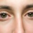 This is how exercise exhausts your eyes
