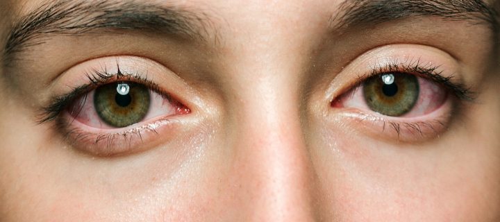 This is how exercise exhausts your eyes