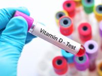 How to Get Your Vitamin D Levels Checked