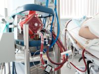 What is ECMO Treatment for COVID-19 and Why Do People Want it So Much?
