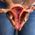 These are the symptoms of endometrial cancer